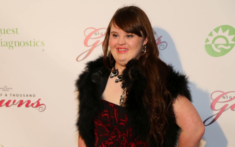 jamie-brewer-η-πρώτη-γυναίκα-μοντέλο-με-σύνδρο-2068448