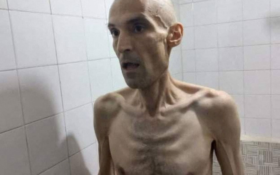 ιράν-οργή-για-τον-απεργό-πείνας-γιατρό-562260955