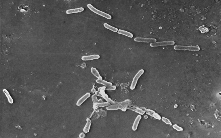 Τα υπερμικρόβια: Η «αθόρυβη πανδημία» που σκοτώνει εκατομμύρια ανθρώπους κάθε χρόνο